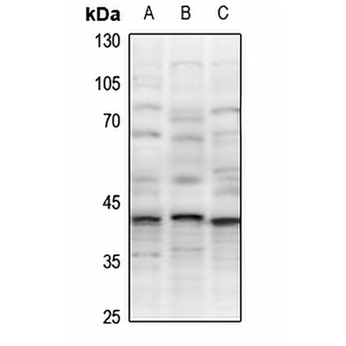XRCC3 Rabbit Polyclonal Antibody