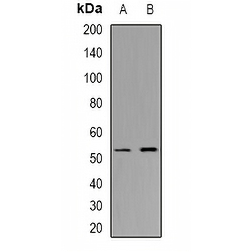 CHST9 Rabbit Polyclonal Antibody