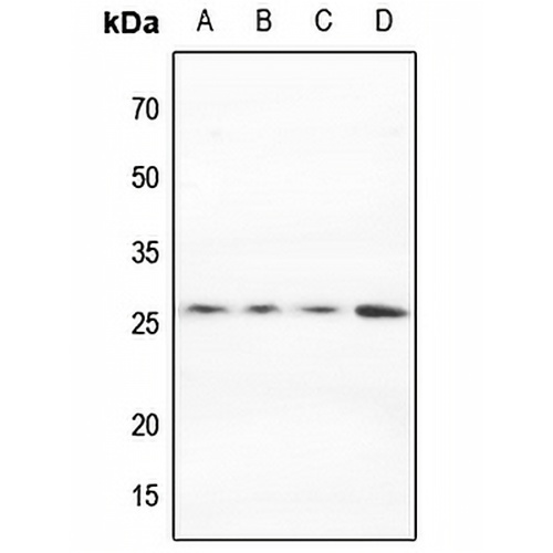 MARCH2 Rabbit Polyclonal Antibody