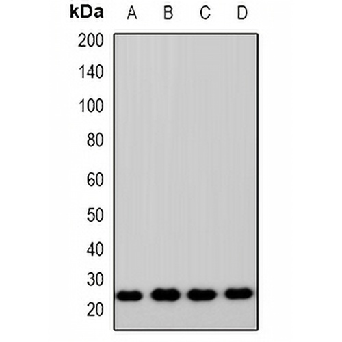 ZNRF2 Rabbit Polyclonal Antibody