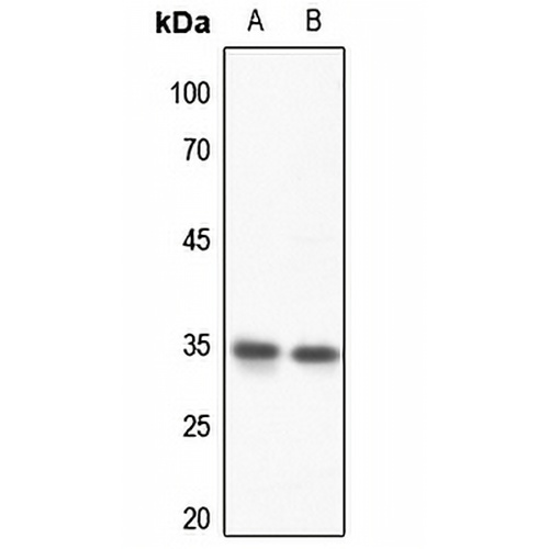 HOXD13 Rabbit Polyclonal Antibody