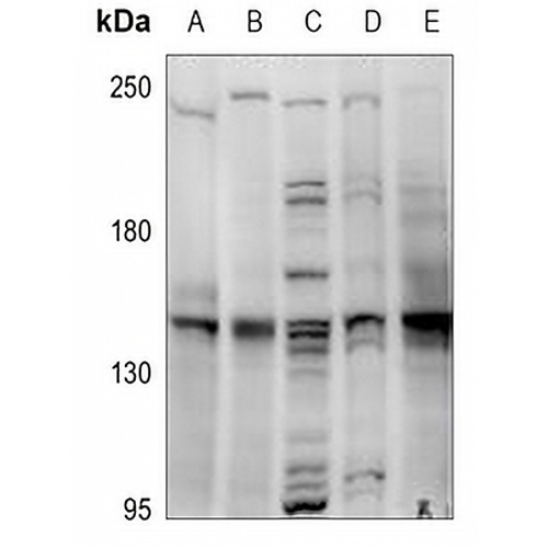 MYBPC3 Rabbit Polyclonal Antibody