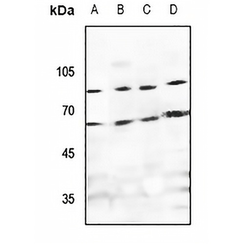TAGAP Rabbit Polyclonal Antibody