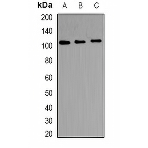 TRAK2 Rabbit Polyclonal Antibody