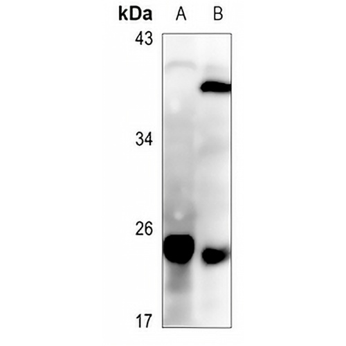 SFT2D3 Rabbit Polyclonal Antibody