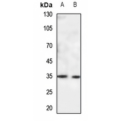 CACNG5 Rabbit Polyclonal Antibody