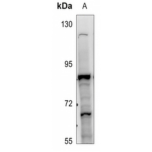 ZNF600 Rabbit Polyclonal Antibody