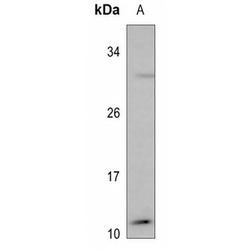 MYCBP Rabbit Polyclonal Antibody