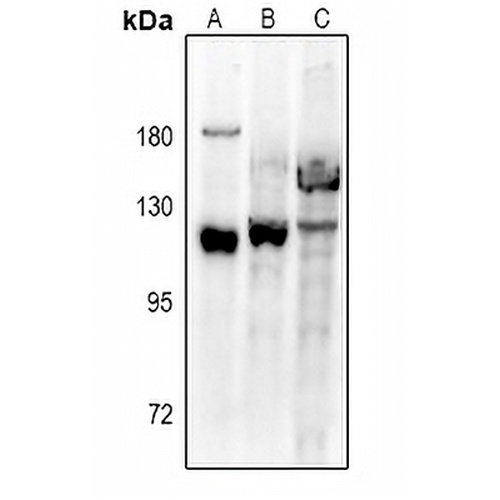 VPS54 Rabbit Polyclonal Antibody