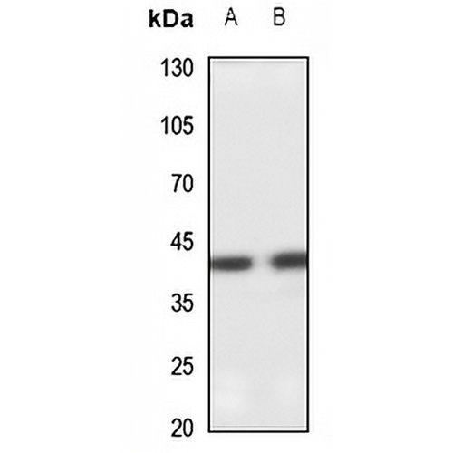 SETMAR Rabbit Polyclonal Antibody