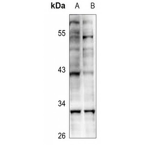KLF13 (Acetyl-K166) Rabbit Polyclonal Antibody