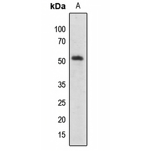 SMAD2/3 (Acetyl-K19) Rabbit Polyclonal Antibody