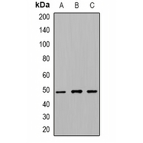 Beta-tubulin (Acetyl-K379) Rabbit Polyclonal Antibody