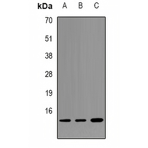Alpha-synuclein (Phospho-Y125) Rabbit Polyclonal Antibody