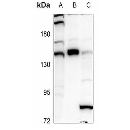 GLI1 Rabbit Polyclonal Antibody