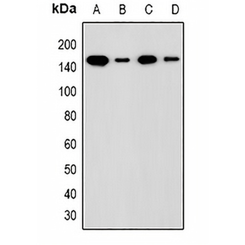ADNP Rabbit Polyclonal Antibody