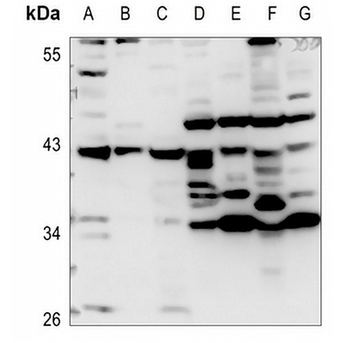 Apolipoprotein A5 Rabbit Polyclonal Antibody
