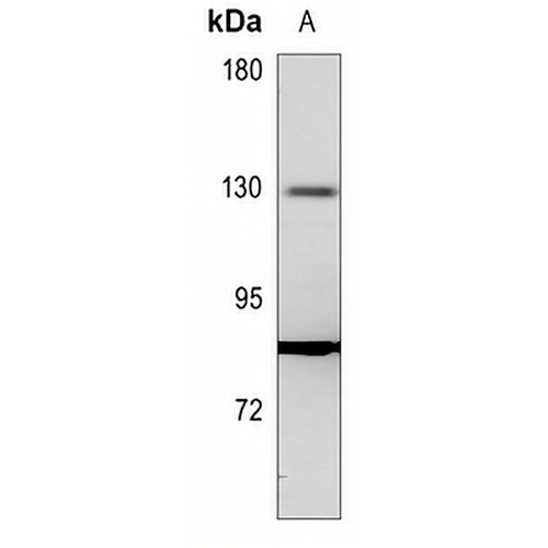 ALPK1 Rabbit Polyclonal Antibody