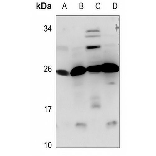 CIDEB Rabbit Polyclonal Antibody