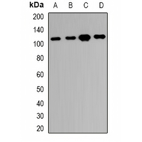 RBM26 Rabbit Polyclonal Antibody