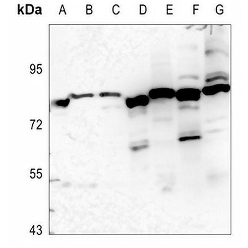 EPS8L1 Rabbit Polyclonal Antibody