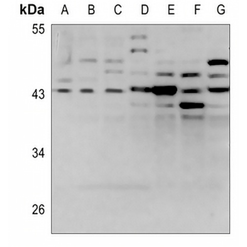 LPAAT gamma Rabbit Polyclonal Antibody