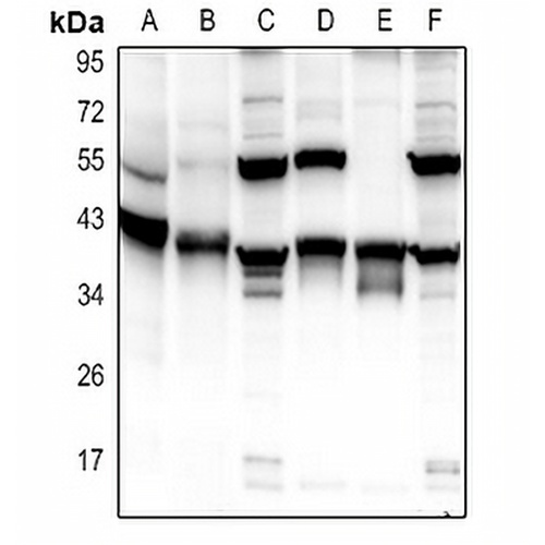 Carbonic Anhydrase 13 Rabbit Polyclonal Antibody