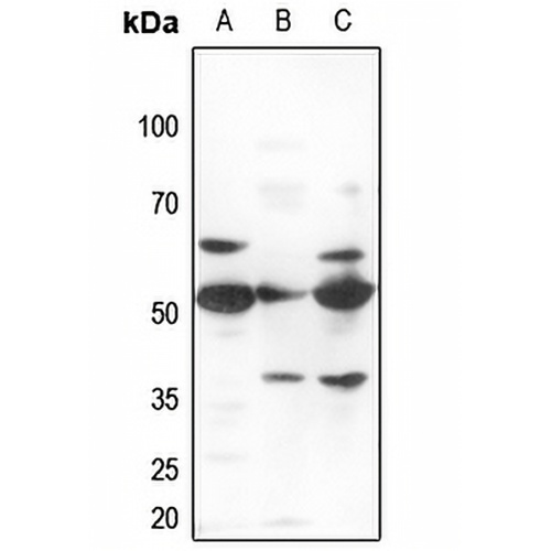 ZNF498 Rabbit Polyclonal Antibody