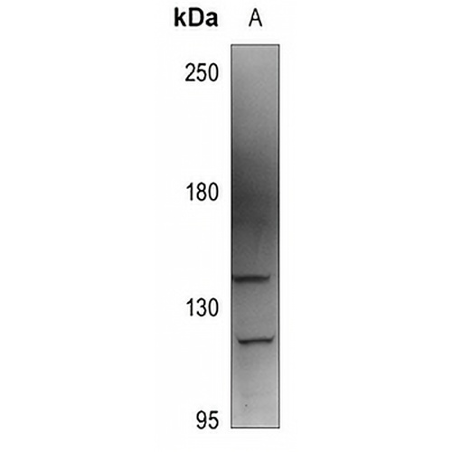 AAK1 Rabbit Polyclonal Antibody