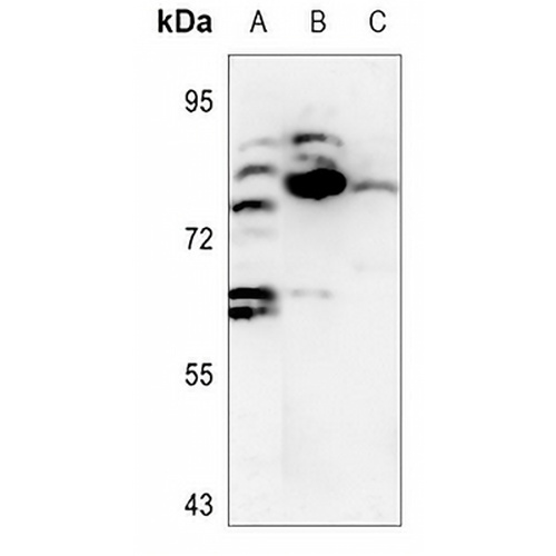 DCLK2 Rabbit Polyclonal Antibody