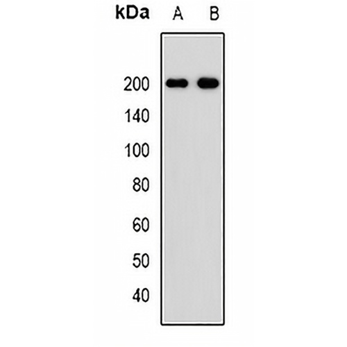PDGFR beta Rabbit Polyclonal Antibody