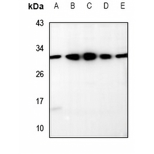 RRP7A/B Rabbit Polyclonal Antibody