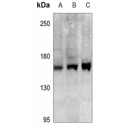 SCP2 Rabbit Polyclonal Antibody