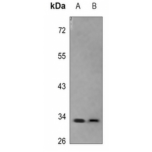 SCP3 Rabbit Polyclonal Antibody