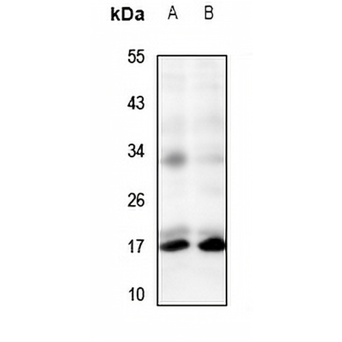 TRP14 Rabbit Polyclonal Antibody