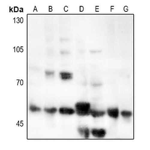 CD126 Rabbit Polyclonal Antibody