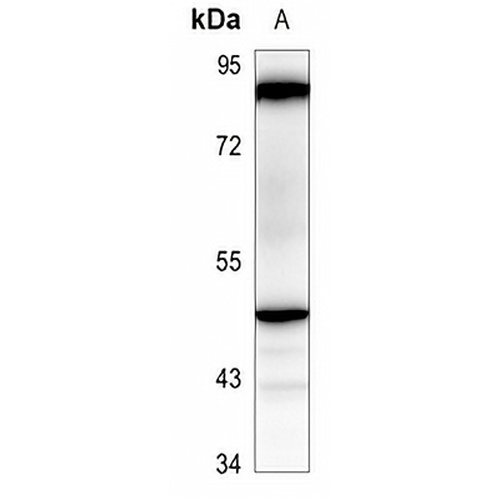 IKK gamma Rabbit Polyclonal Antibody