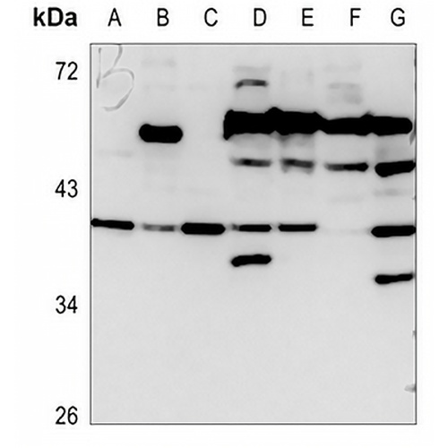 CD129 Rabbit Polyclonal Antibody