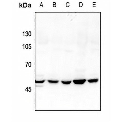 GDI2 Rabbit Polyclonal Antibody