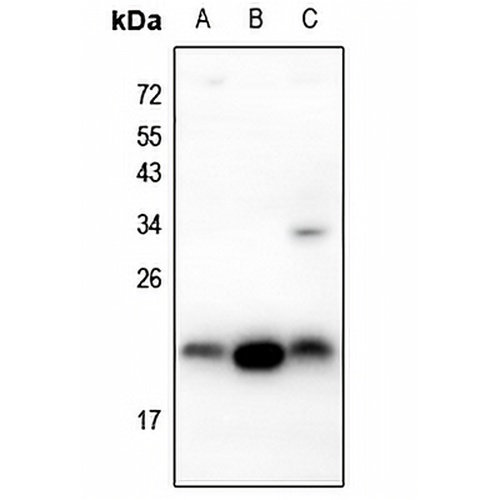 IGF1 Rabbit Polyclonal Antibody