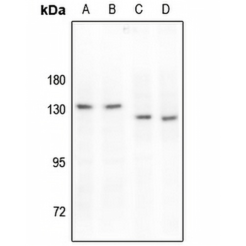 MERTK/TYRO3 (Phospho-Y749/681) Rabbit Polyclonal Antibody