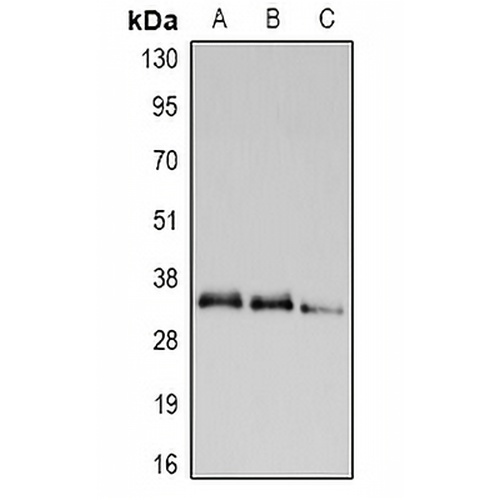 UCP2 Rabbit Polyclonal Antibody