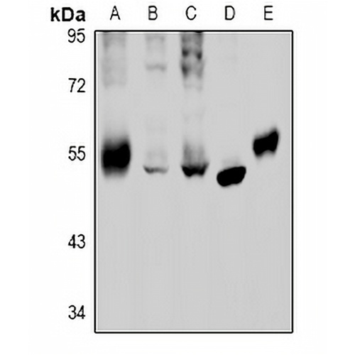 GABRB2 Rabbit Polyclonal Antibody