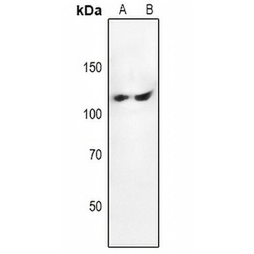 Focal Adhesion Kinase Rabbit Polyclonal Antibody