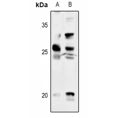 Thymidine Kinase 1 Rabbit Polyclonal Antibody