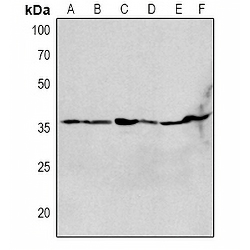 CHRNA1 Rabbit Polyclonal Antibody