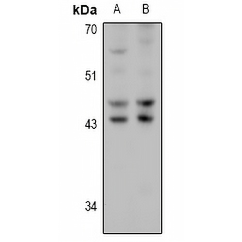 HSD17B2 Rabbit Polyclonal Antibody