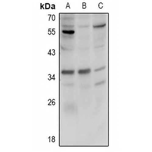 FR beta Rabbit Polyclonal Antibody
