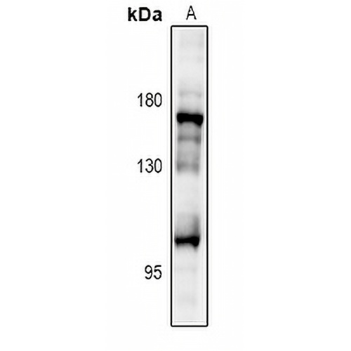IRS2 Rabbit Polyclonal Antibody