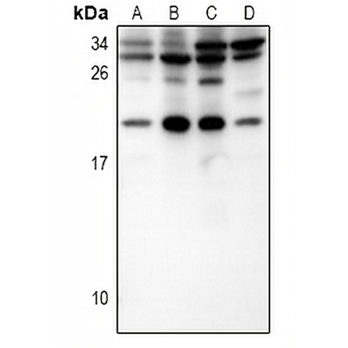 IL-15 Rabbit Polyclonal Antibody